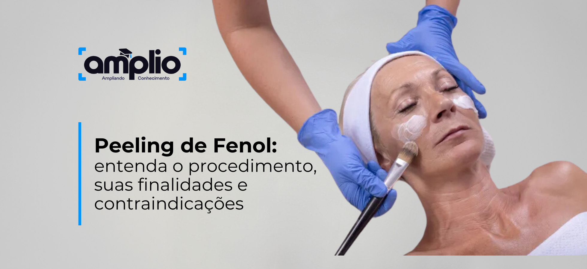 Peeling de Fenol: entenda o procedimento, suas finalidades e contraindicações